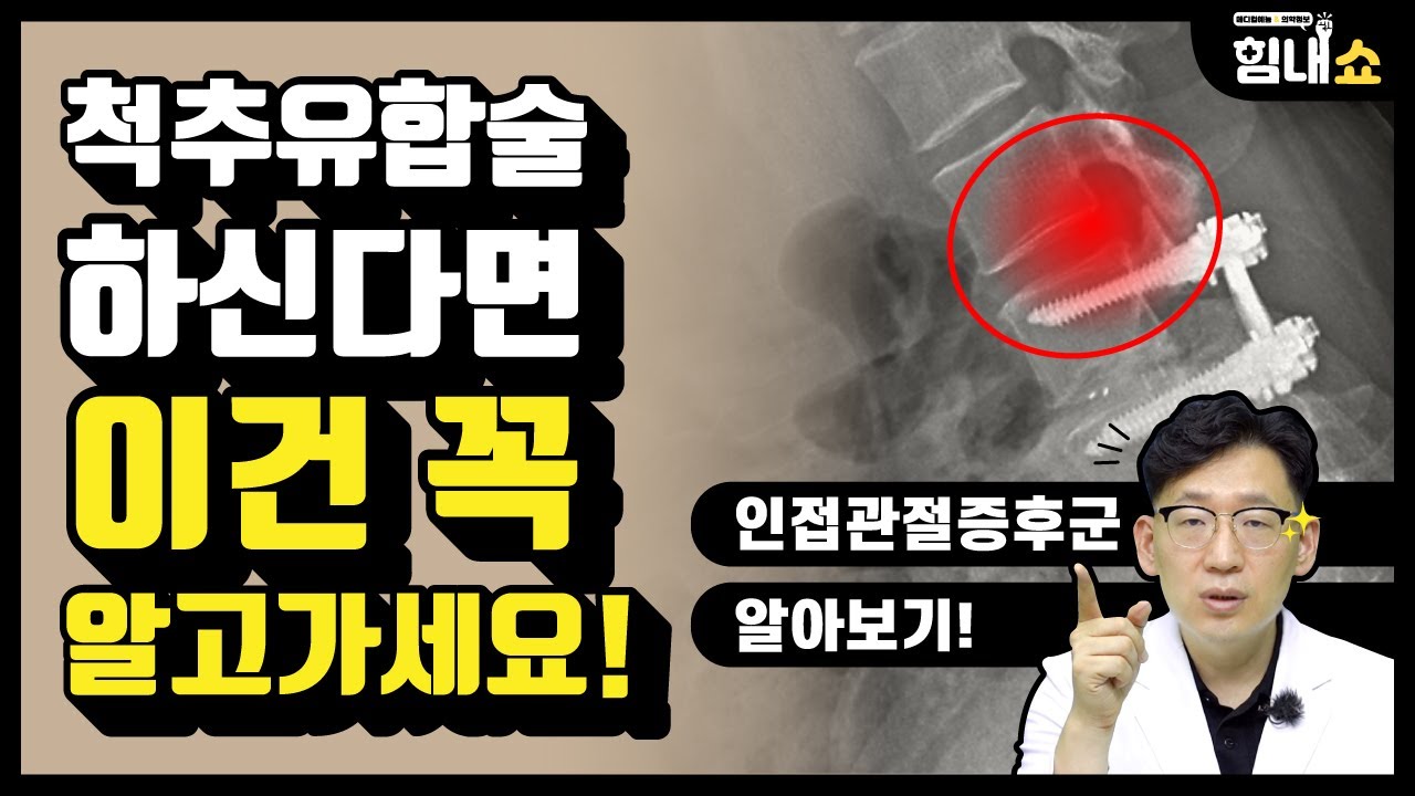 힘내쇼 168화 척추유합술을 하신다면 이건 꼭 알고가세요!