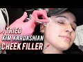 I GOT KIM KARDASHIAN CHEEK & LIP FILLER | Amanda Ensing