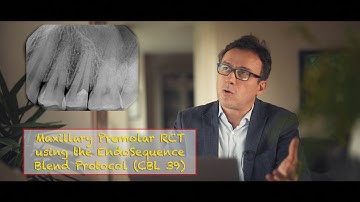 Premolar Root Canal using EndoSequence Blend Protocol CBL 37