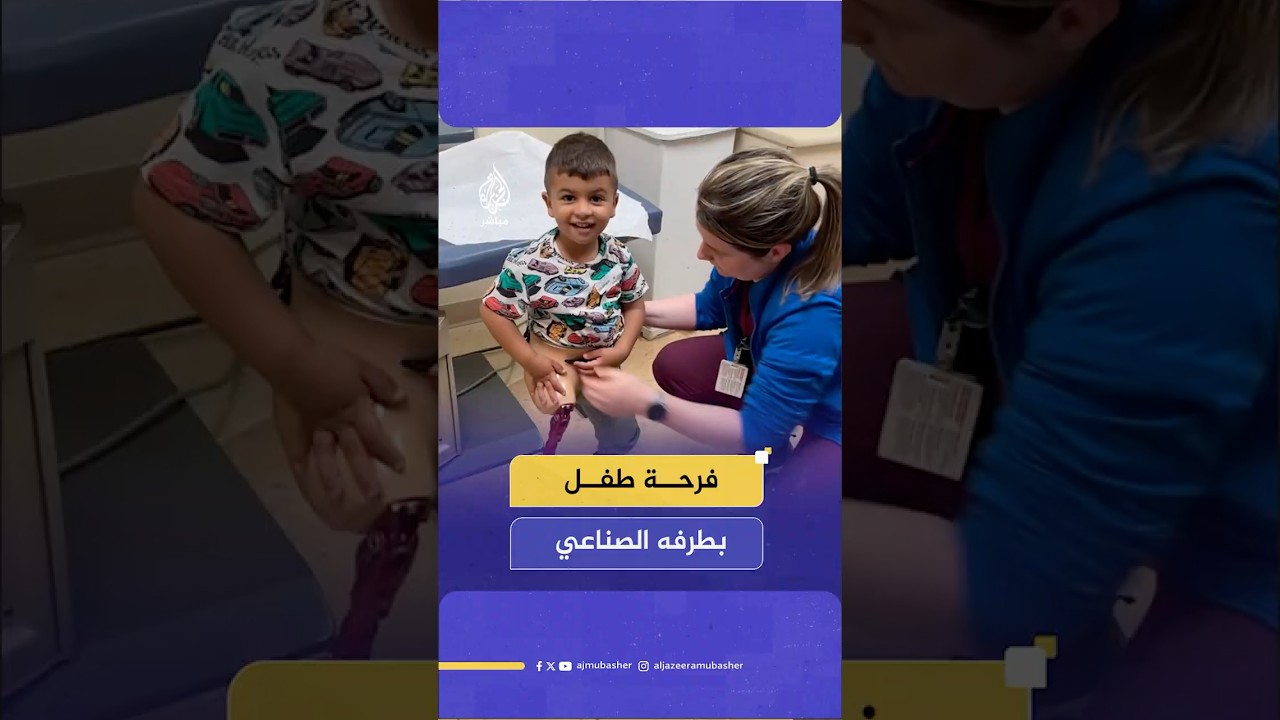 الطفل آدم أبو فوجو يخطو أولى خطواته بطرف صناعي في شيكاغو
