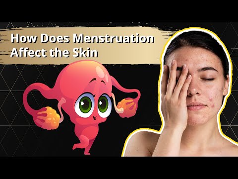 Video: Je pokožka počas menštruácie mastnejšia?