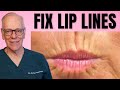 How a plastic surgeon treats lip lines