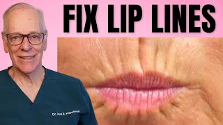 How a Plastic Surgeon Treats Lip Lines screenshot 4