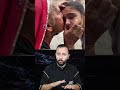 لحس العين للعلاج