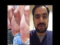 خدران الفخذ