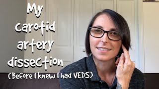 My Carotid Artery Dissection with VEDS (Vascular Ehlers-Danlos syndrome)