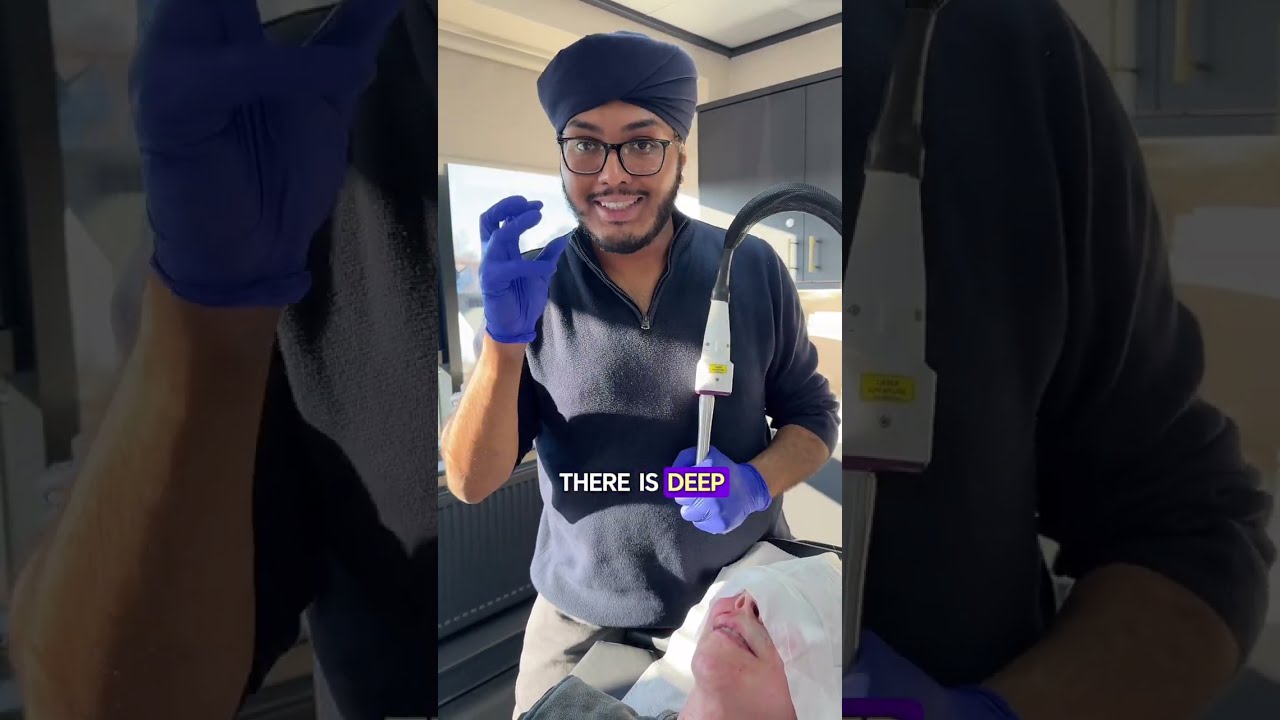 Fully Ablative Laser Resurfacing for Upper Lip Lines | UltraClear Laser Smokers Lines Treatment UK