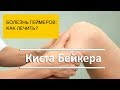 Киста Бейкера, болезнь малоподвижных и гемейров: как избежать?