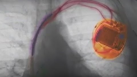 Could Hackers Threaten the Future of Medical Devices?