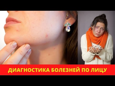 Диагностика болезней по лицу. Обучение.