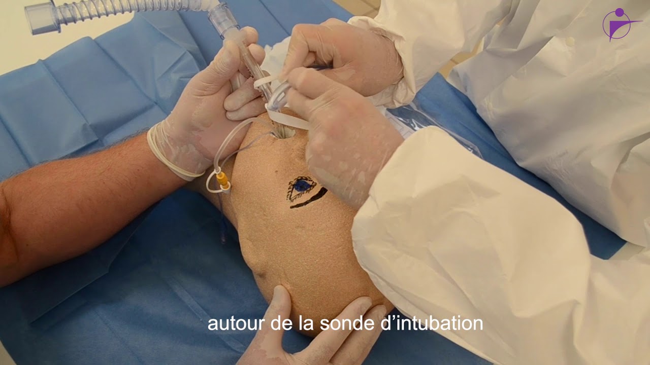 Cair LGL - Lacettes de fixation pour sondes trachéales