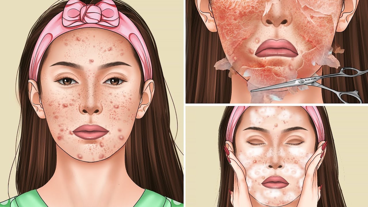 ASMR Chemical peeling skin on the face | Dermaplaning skincare treatment animation