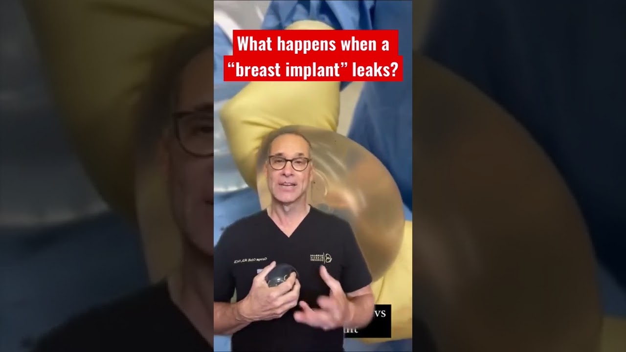 What happens when a “breast implant” leaks?