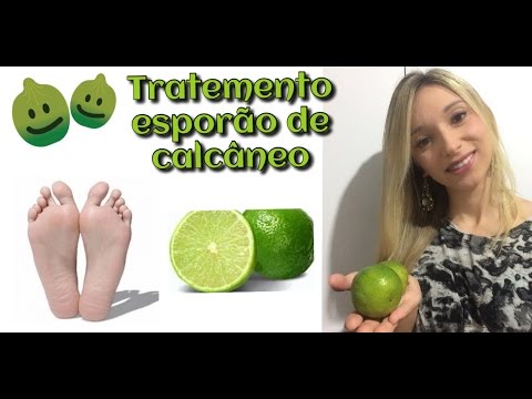 Vídeo: Uma Receita Popular Eficaz Para O Tratamento De Esporas De Calcanhar