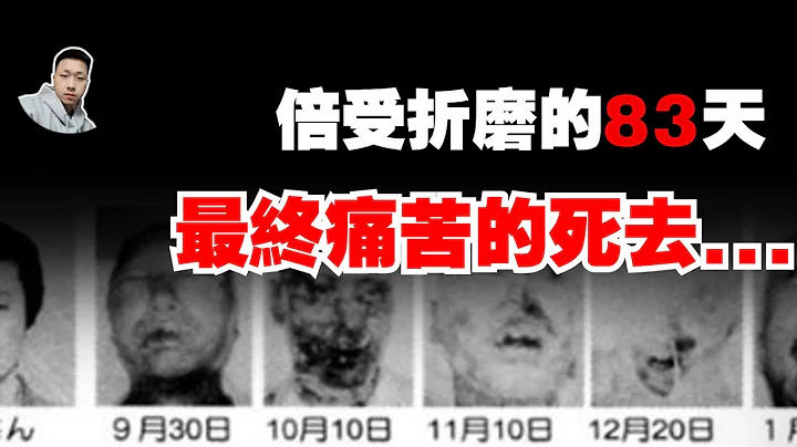 這個影片會告訴你核輻射有多可怕！| 東海村核事故 - 天天要聞