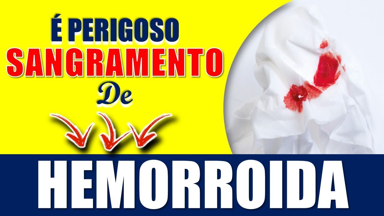 Hemorroida Sangrando o que Fazer - Porque a Hemorroida Sangra - YouTube
