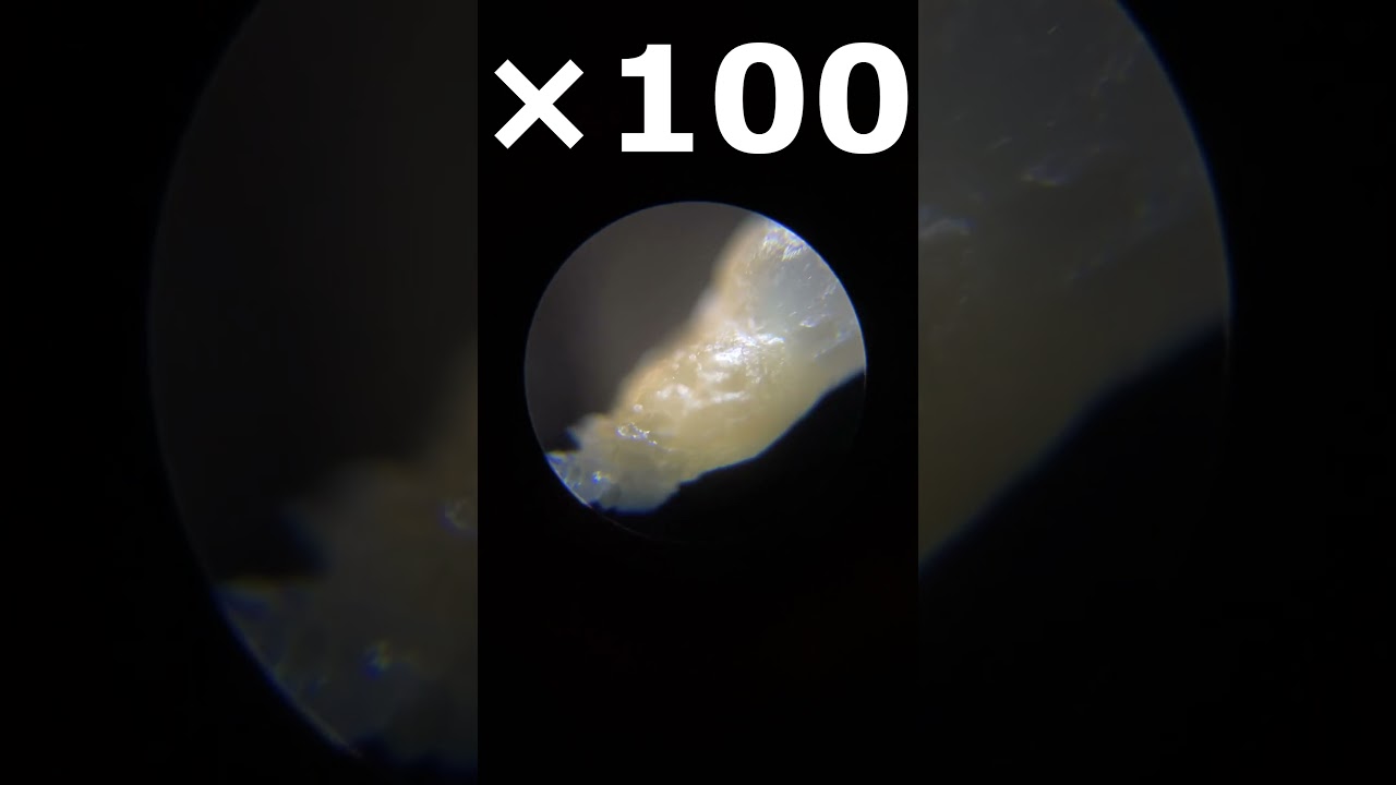 Blackhead microscope ×40 ×100 