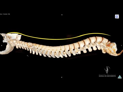 Vídeo: Os Danos No DNA Se Acumulam E As Respostas Estão Envolvidas Nos Neurônios Motores Da ALS Do Cérebro E Da Coluna Vertebral E O Reparo Do DNA é Ativável Nos Neurônios Motores Derivad