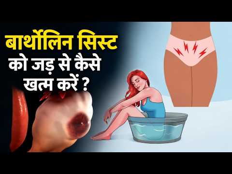 Bartholin Cyst Causes: प्राइवेट पार्ट में बार बार दर्द,जलन और सूजन का कारण,इलाज |Boldsky Hindi