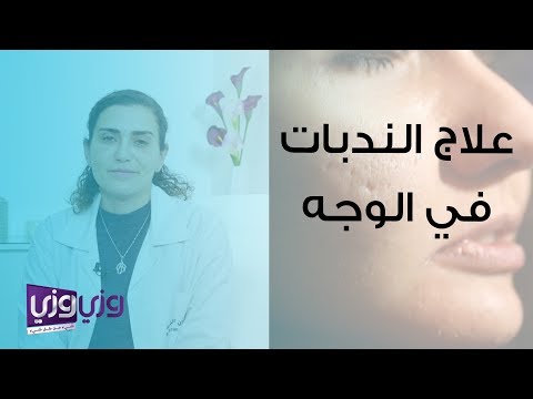 علاج الندبات في الوجه