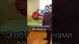 Фізична терапія в ортопедії. Відновлення після травми плодового суглоба. #фізичнатерапія