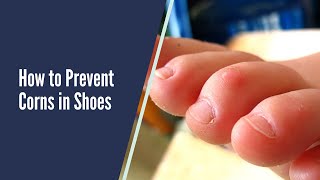HOW TO PREVENT REDNESS AND CORNS ON TOES