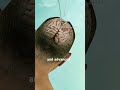 Craniectomy brain surgery (3D animation) #science #slipdiscsurgery #3danimation #facts #drone