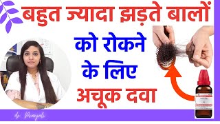 Balon ka jhadna kaise roke | balon ka jhadna kaise kam karen | hair fall solution at home