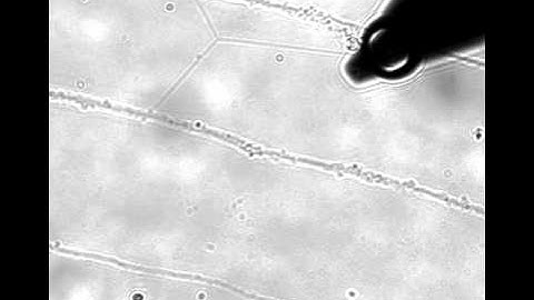 Rewiring Neuronal Connections