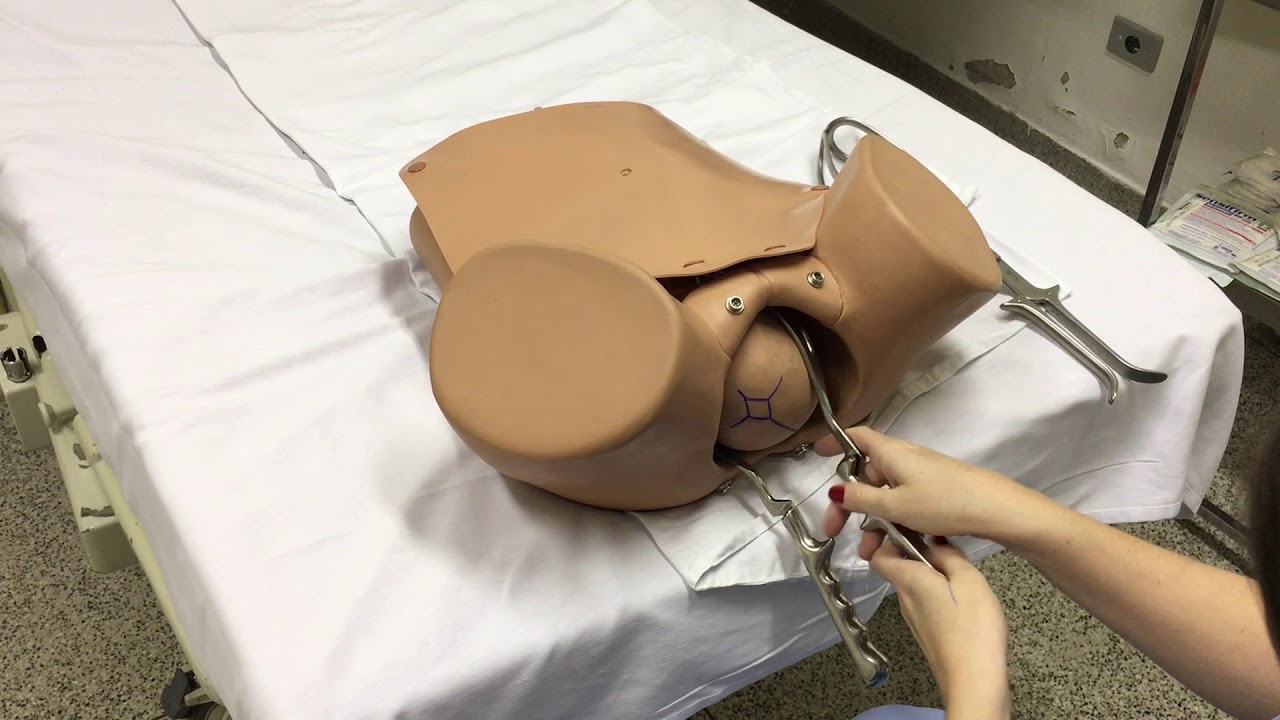 Técnica de aplicação do fórcipe de Simpson em OEP