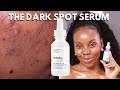 ALPHA ARBUTIN THE ORDINARY |THE TRUTH ABOUT THE ORDINARY ALPHA ARBUTIN |HOW TO GET RID OF DARK SPOT