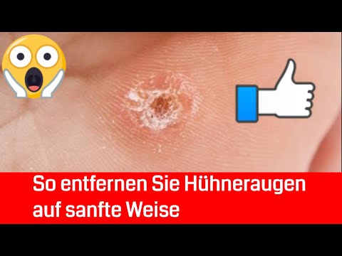 Video: So Entfernen Sie Hühnergeruch