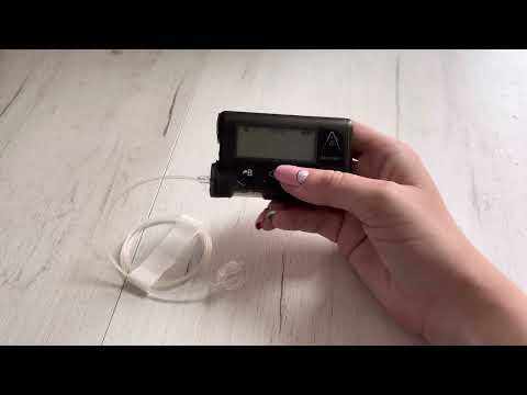 Обзор инсулиновой помпы Медтроник 554. Настраиваем вместе