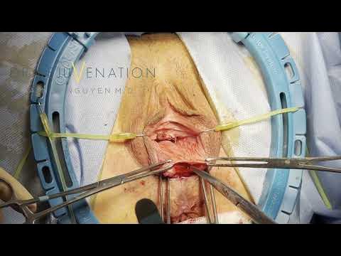 Xorozni teshikka mahkam boglang Ikki joja bilan tabiatda jinsiy aloqa