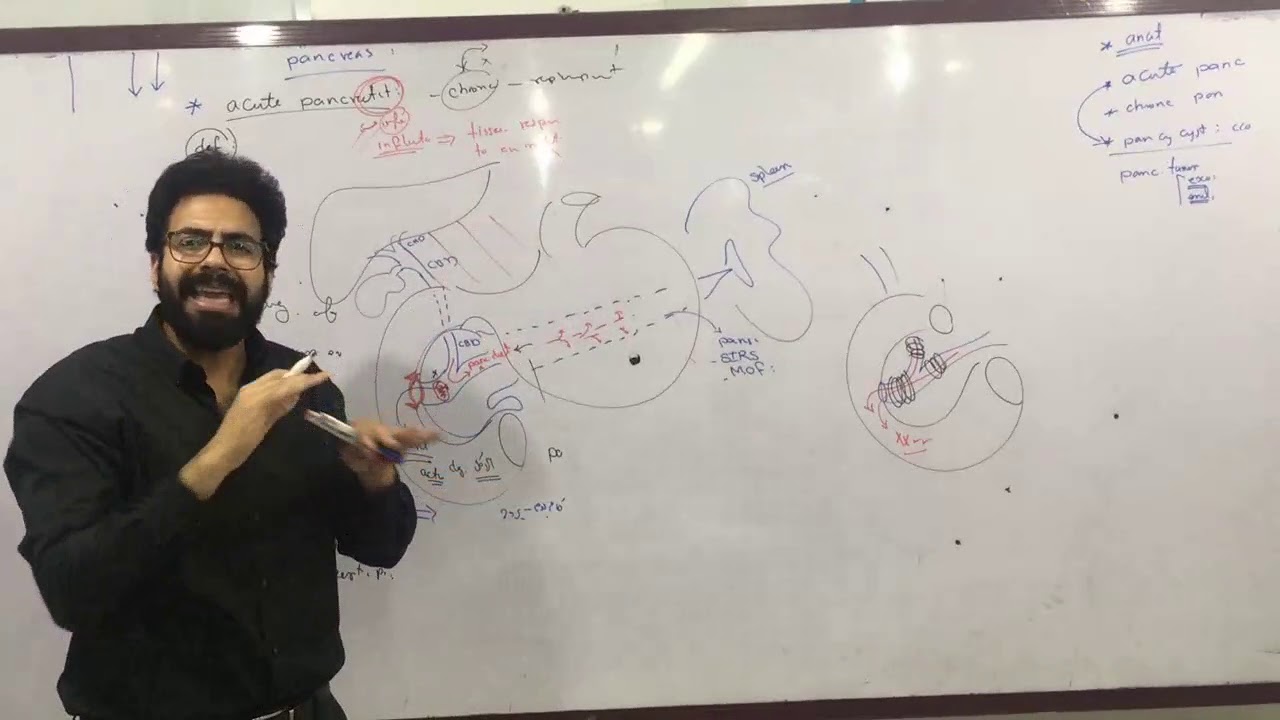 GIT Surgery: Acute Pancreatitis