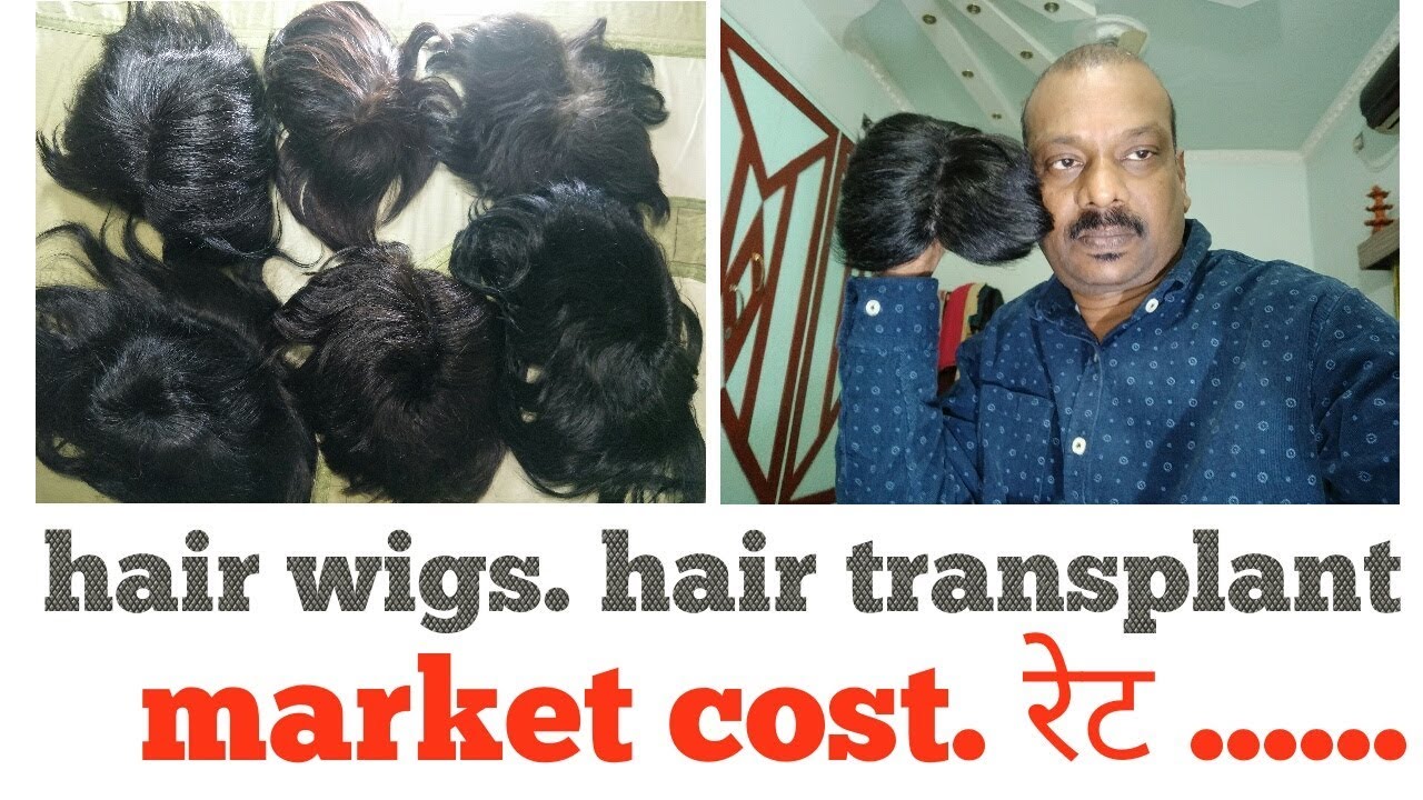 Hair wigs. Hair transplant. Wigs market रेट । Bipin YouTube
