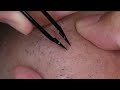 【kenuki010】Agradable vídeo de tirones de pelo