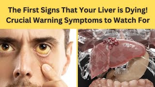 The First Signs Your Liver is Dying: Early Symptoms to Watch For