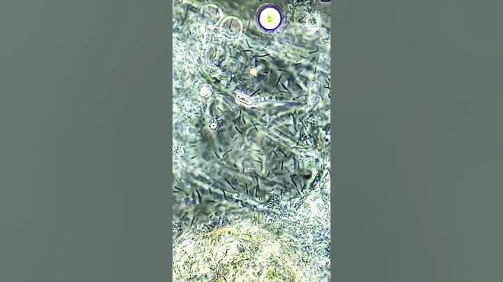 Bacteria VS hydrogen peroxide under the microscope