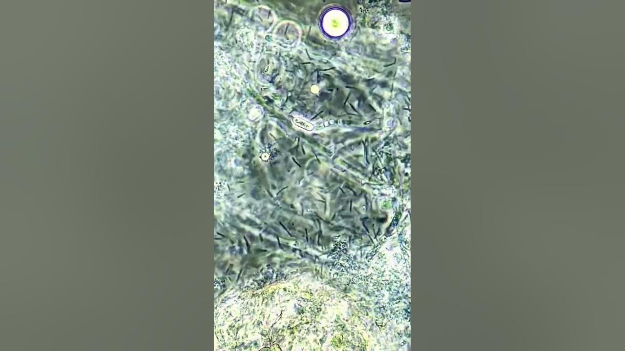 Bacteria vs hydrogen peroxide under the microscope youtube