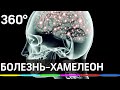 Рассеянный склероз: где в Подмосковье можно получить помощь?