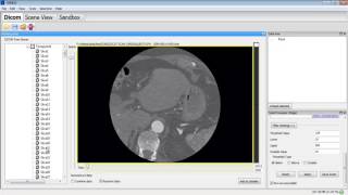 Gimias Matlab 3D Projects