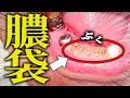 歯の中に『膿袋』！中でばい菌が大量繁殖した結果...