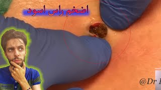 رأس اسود عمره 3 سنوات