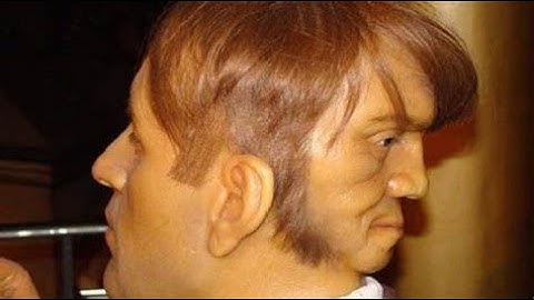 Edward Mordrake, The man who was cursed with Two Human Faces