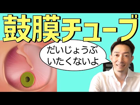 実演： 鼓膜切開/チューブ留置：専門医解説