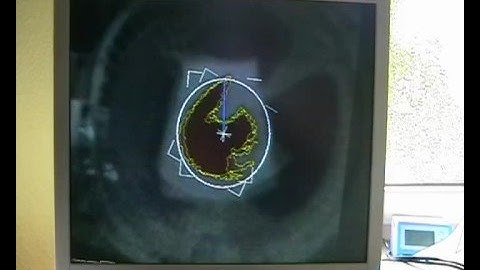 Realtime, high-speed image processing demo