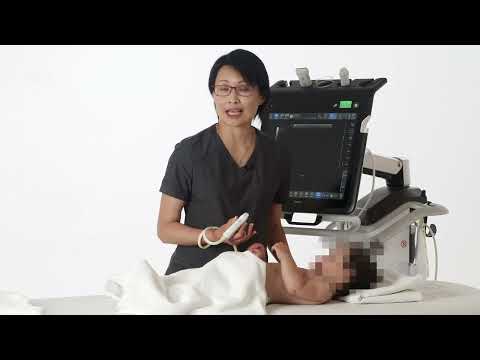 Image of How to scan the anterior and lateral regions of the lung in neonates and children