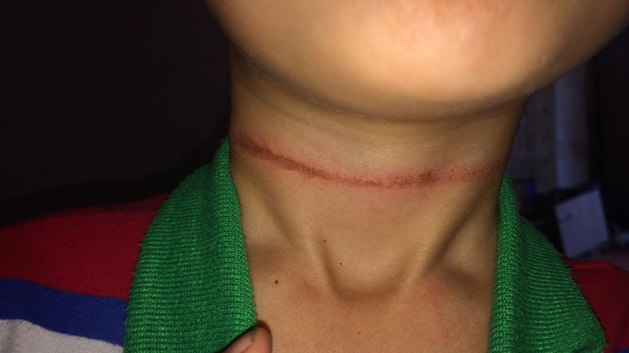 Мальчик едва не повесился в детсадике - YouTube