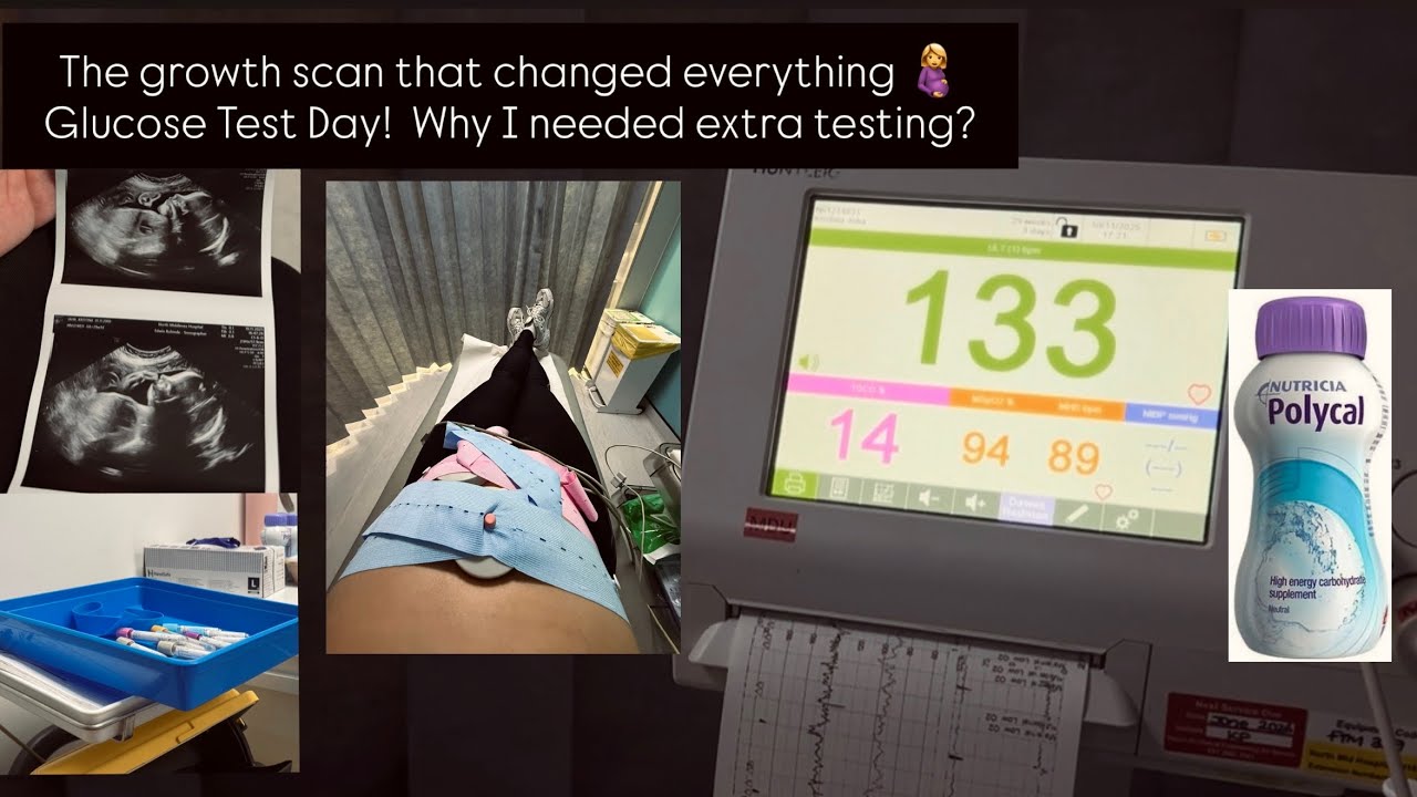 Nuk e prisja…Bebushja ime me SGA! Si e zbulova dhe çfarë ndodhi më pas? Bëjmë testin e diabetit 🤰!